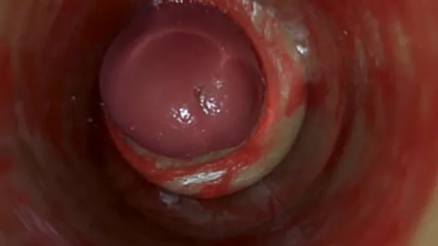 Camera Inside Deep Pussy Captures Huge Ejaculation of Sperm ASMR